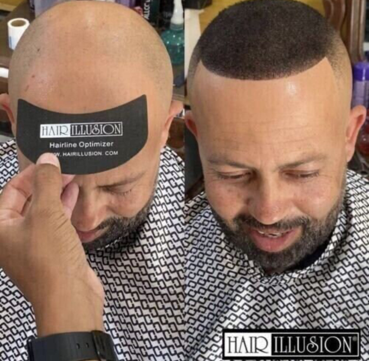 Hair illusion Hairline Optimiser for a More Precise Application When Applying Hair Fibers to the Hairline. - Onohson
